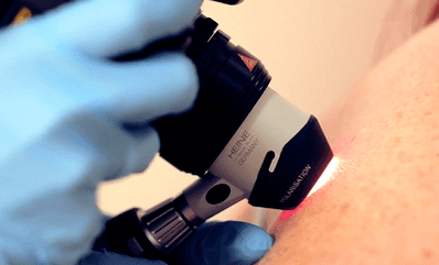 Diagnostilised meetodid plantaarse tüüla jaoks