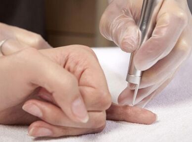 Laserteraapia läbiviimine