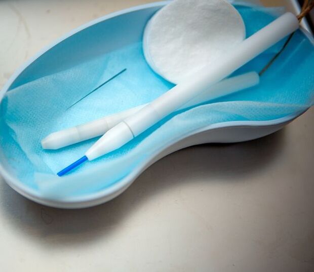 Eemaldamise meetodid